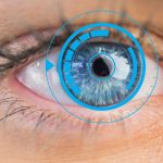 Transpkr ou Lasik